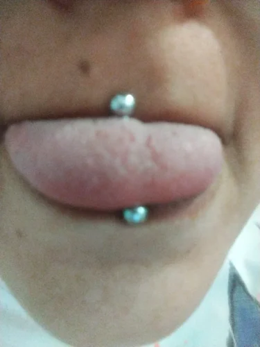 CuteBite™ Tongue Piercing Kit photo review