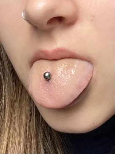 CuteBite™ Tongue Piercing Kit photo review