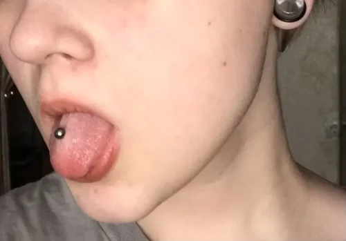 CuteBite™ Tongue Piercing Kit photo review