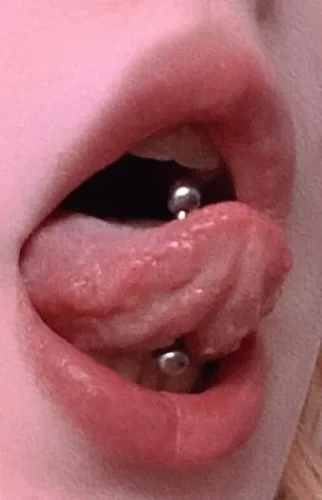 CuteBite™ Tongue Piercing Kit photo review